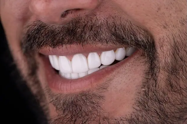 Primer plano de la nueva sonrisa de un paciente — Smile Dental Center