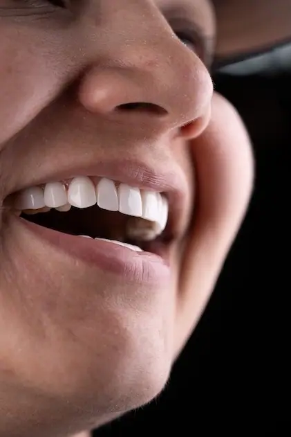 Primer plano de diseño de sonrisa — Smile Dental Center
