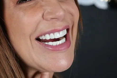 Sonrisa luminosa y natural después de odontología estética